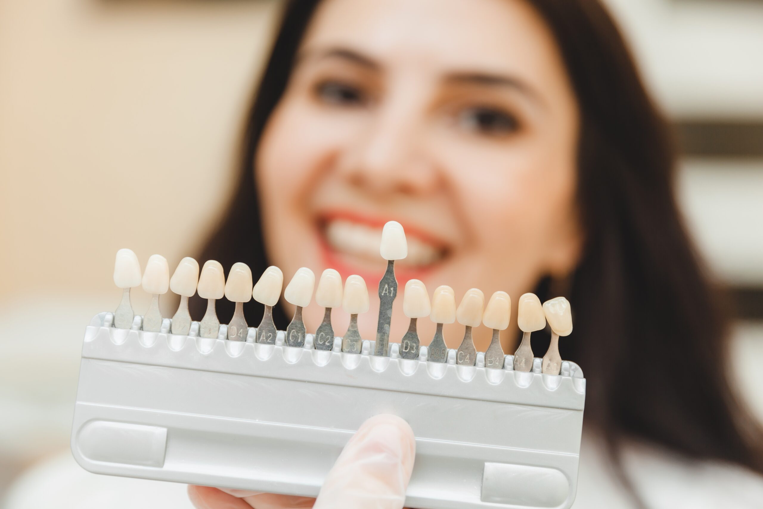 Art and Science of Dental Implants