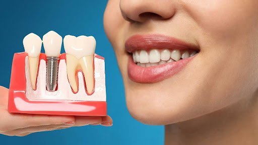 Understand Why Healthy Gums and Bones Matter