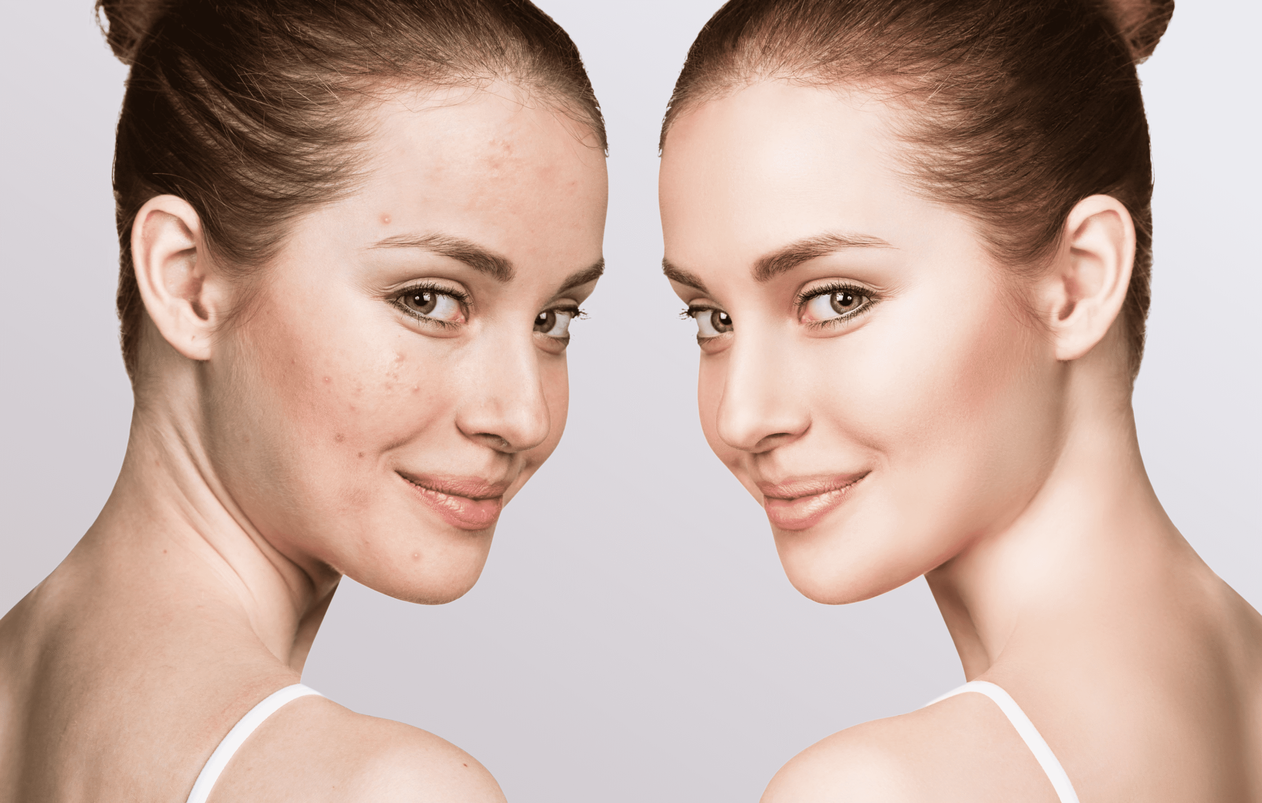 Discover the Amazing Benefits of Aviclear for Health and Wellness